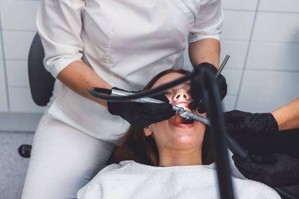 Best Knocked-Out Tooth (Avulsed Tooth) Treatment in Morris, IL